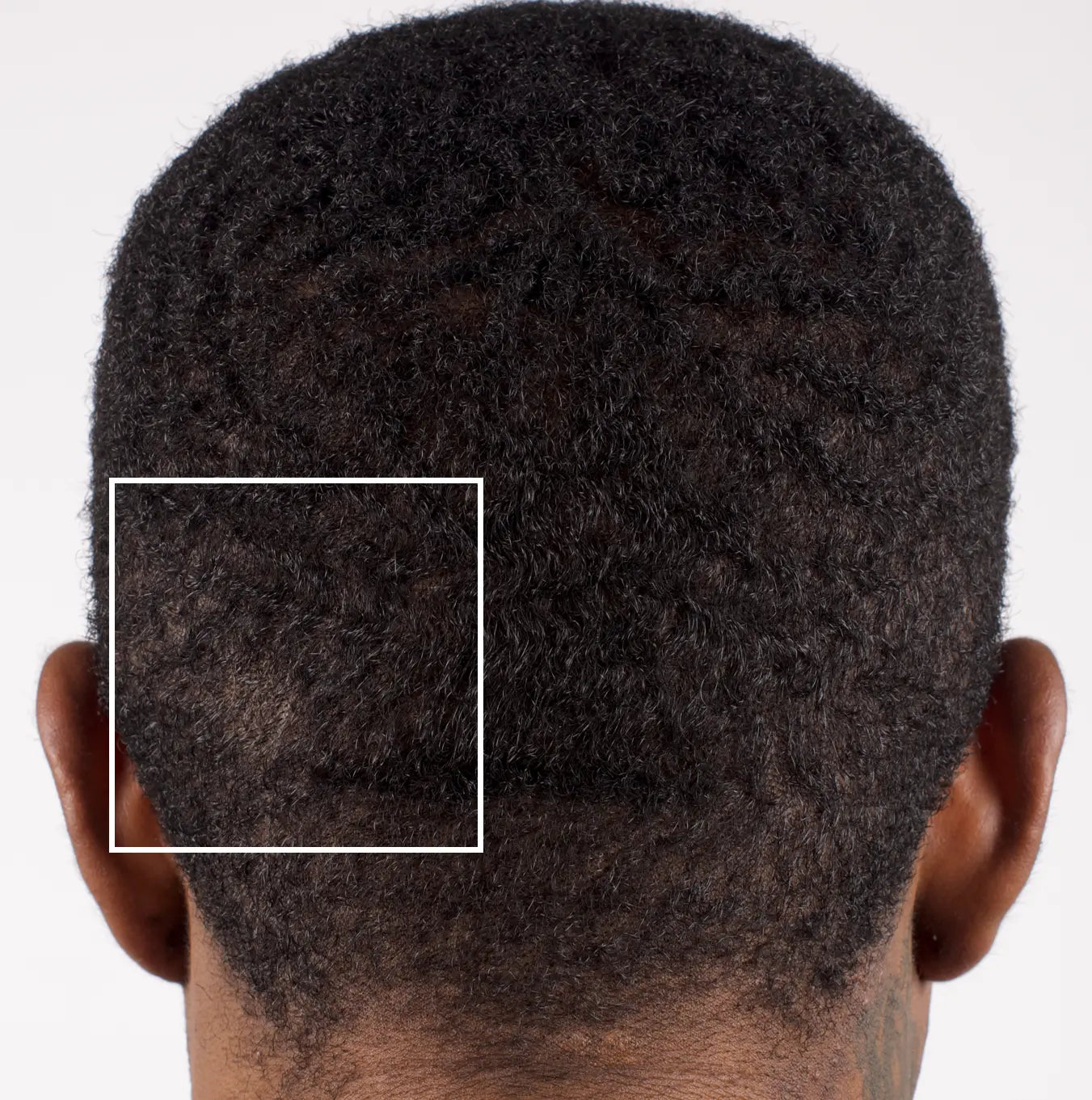 Nu-Cil BioStim Scalp Serum before and after — Male back of head Week 2 results