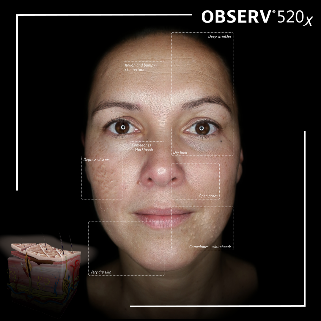 parrelpolarised skin showing ageing and wrinkles - stratumclinic.co.uk