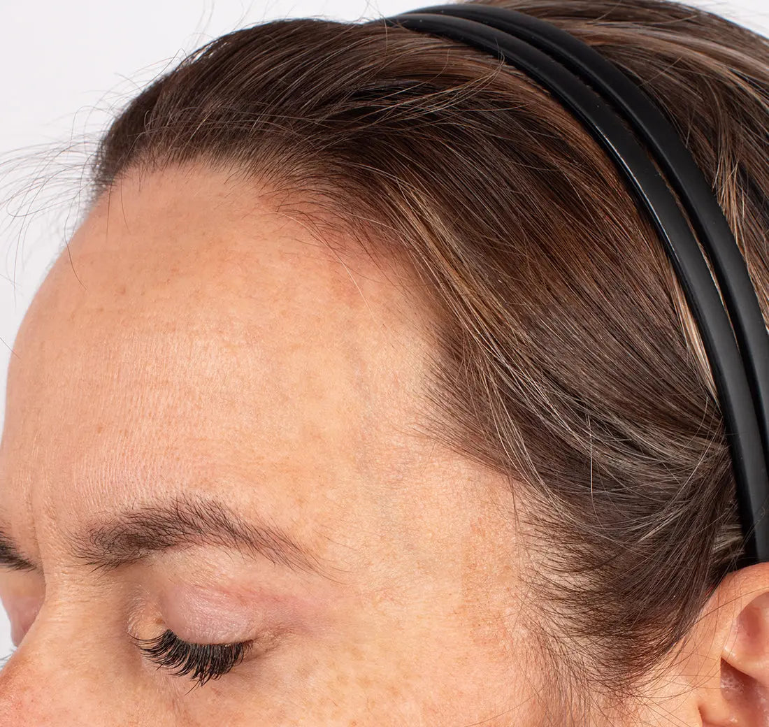 Nu-Cil BioStim Scalp Serum clinical before and after — Subject S61 Week 12 results