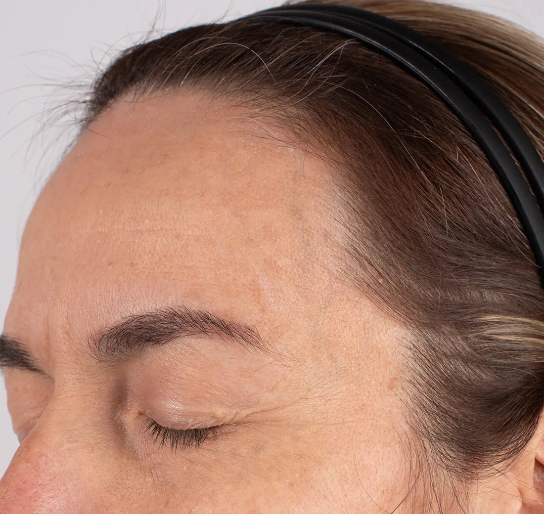 Nu-Cil BioStim Scalp Serum clinical before and after — Subject S61 Week 2 results