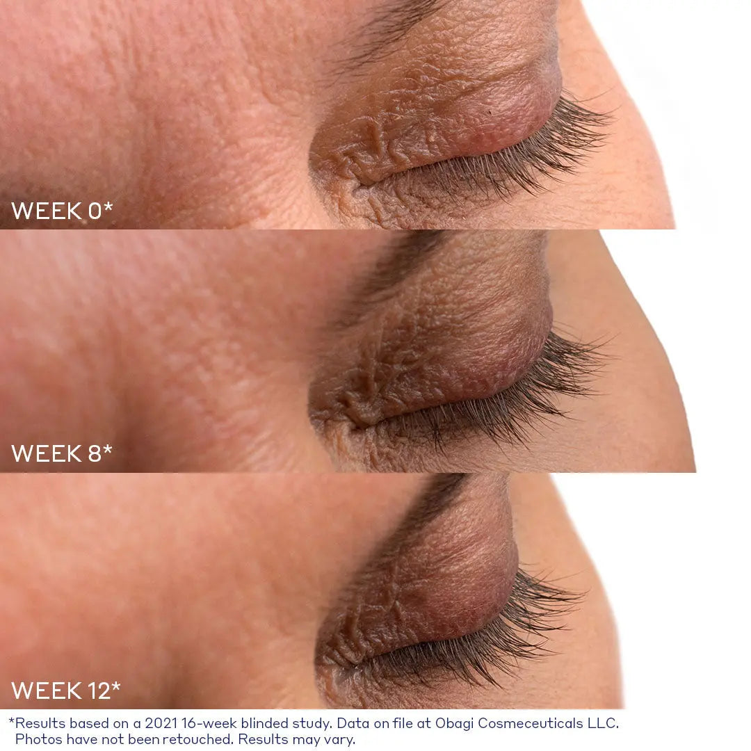 Nu-Cil Eyelash Enhancing Serum before and after — Nu Cil Lash Before Afters 1B