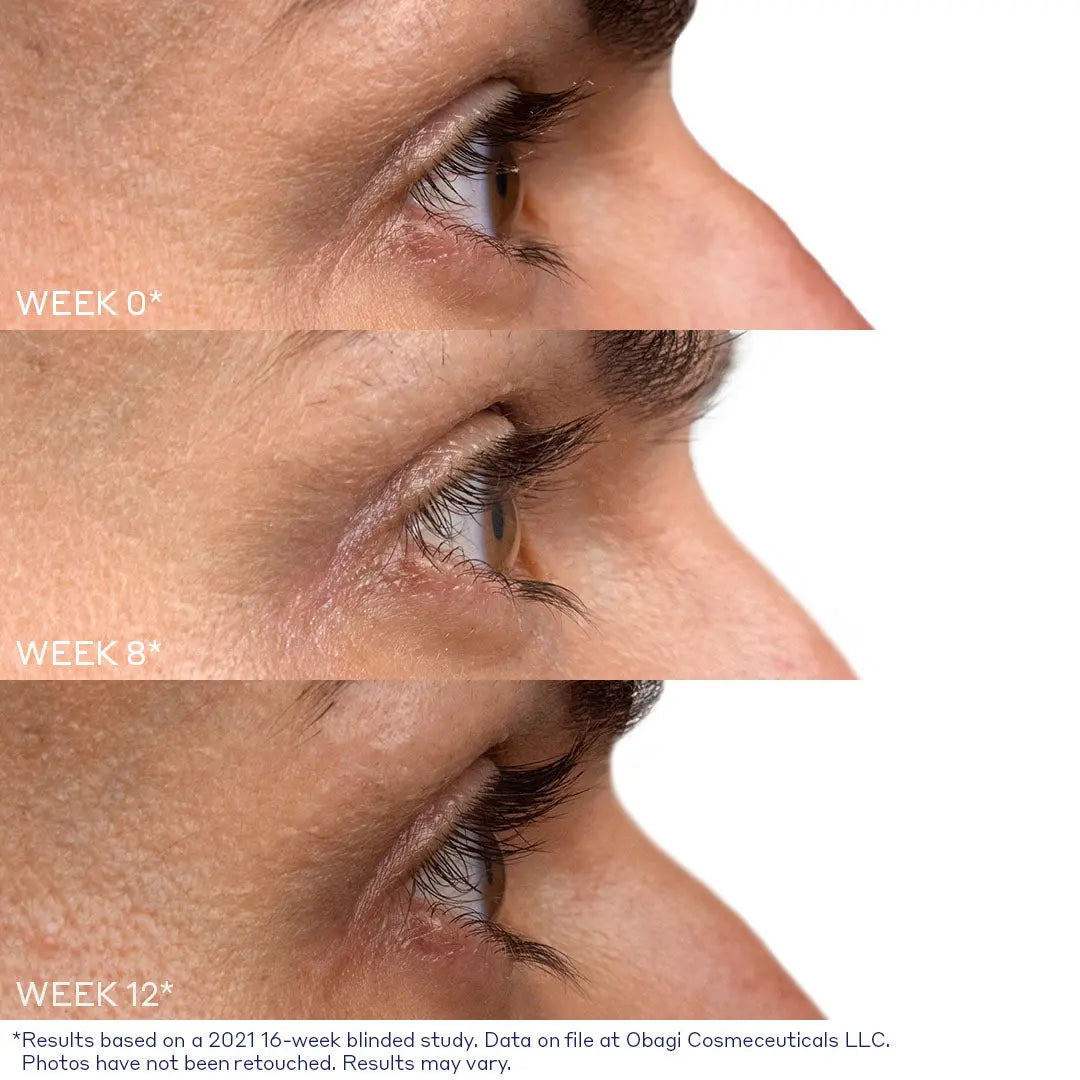 Nu-Cil Eyelash Enhancing Serum before and after — Nu Cil Lash Before Afters 2A