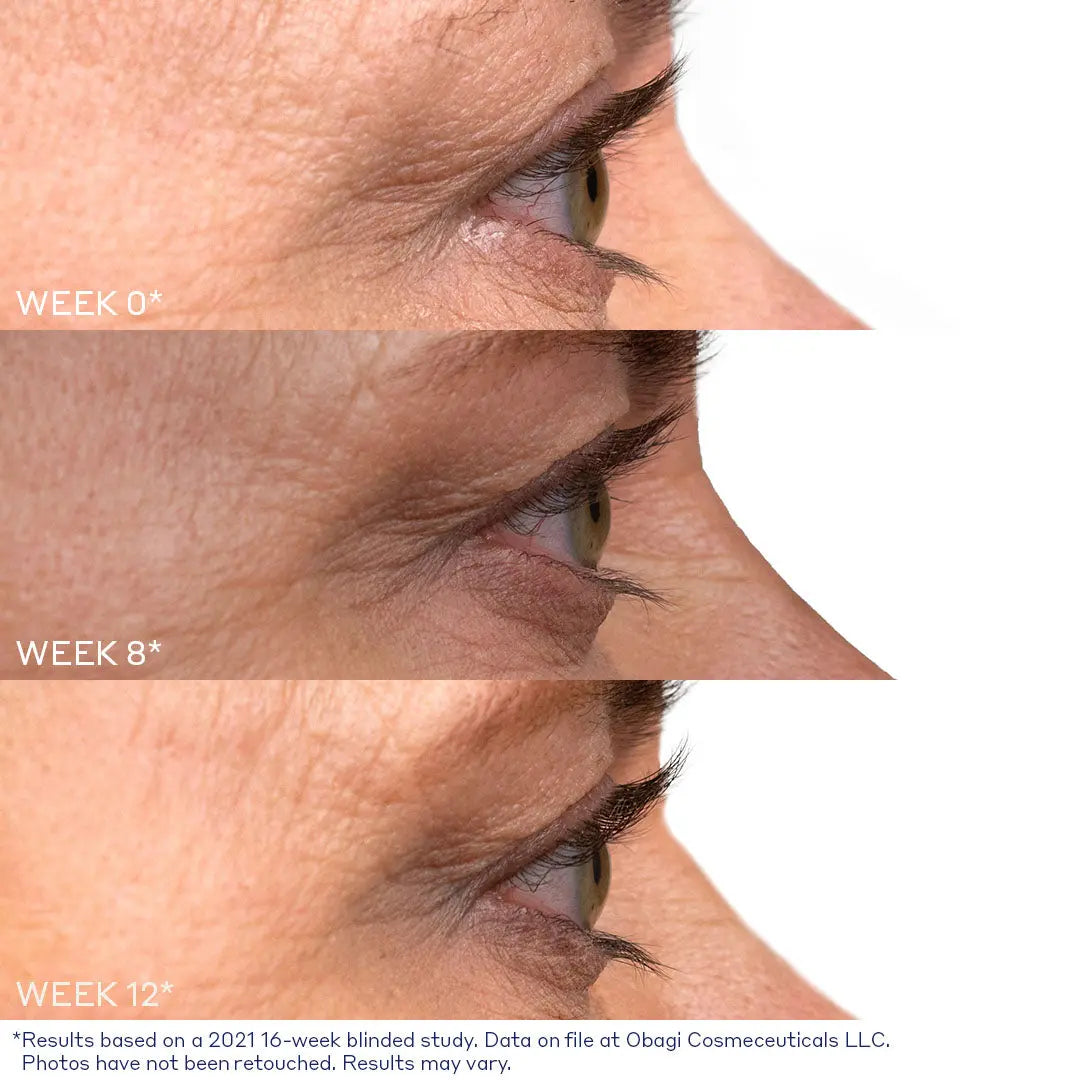 Nu-Cil Eyelash Enhancing Serum before and after — Nu Cil Lash Before Afters 2B