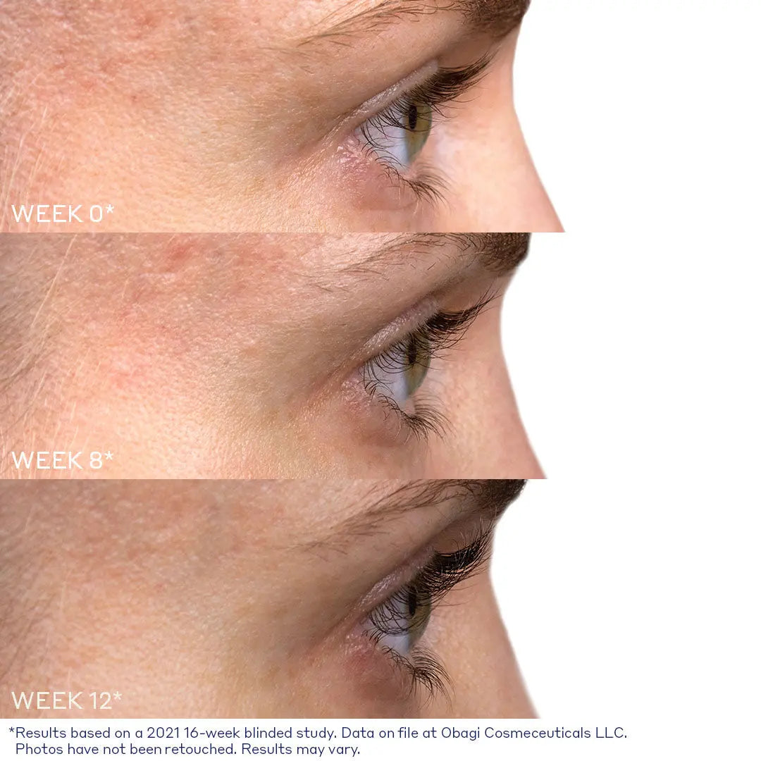 Nu-Cil Eyelash Enhancing Serum before and after — Nu Cil Lash Before Afters 2C