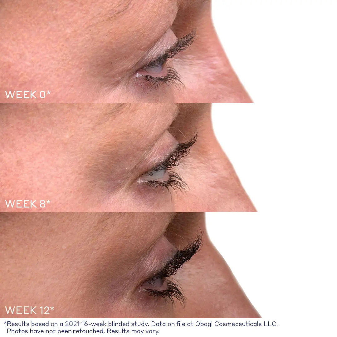 Nu-Cil Eyelash Enhancing Serum before and after — Nu Cil Lash Before Afters 2D