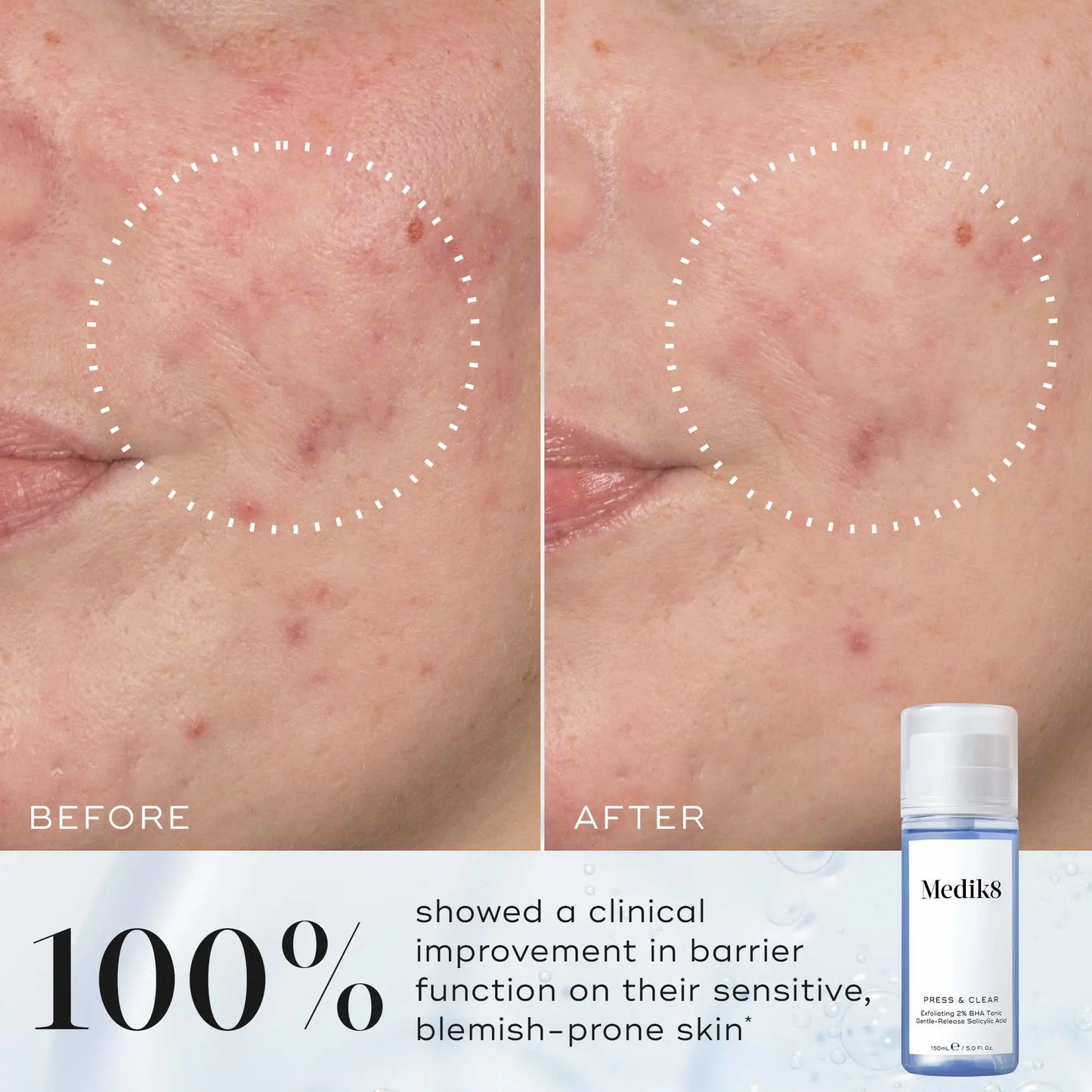 Medik8 Press & Clear 150ml - Image 4