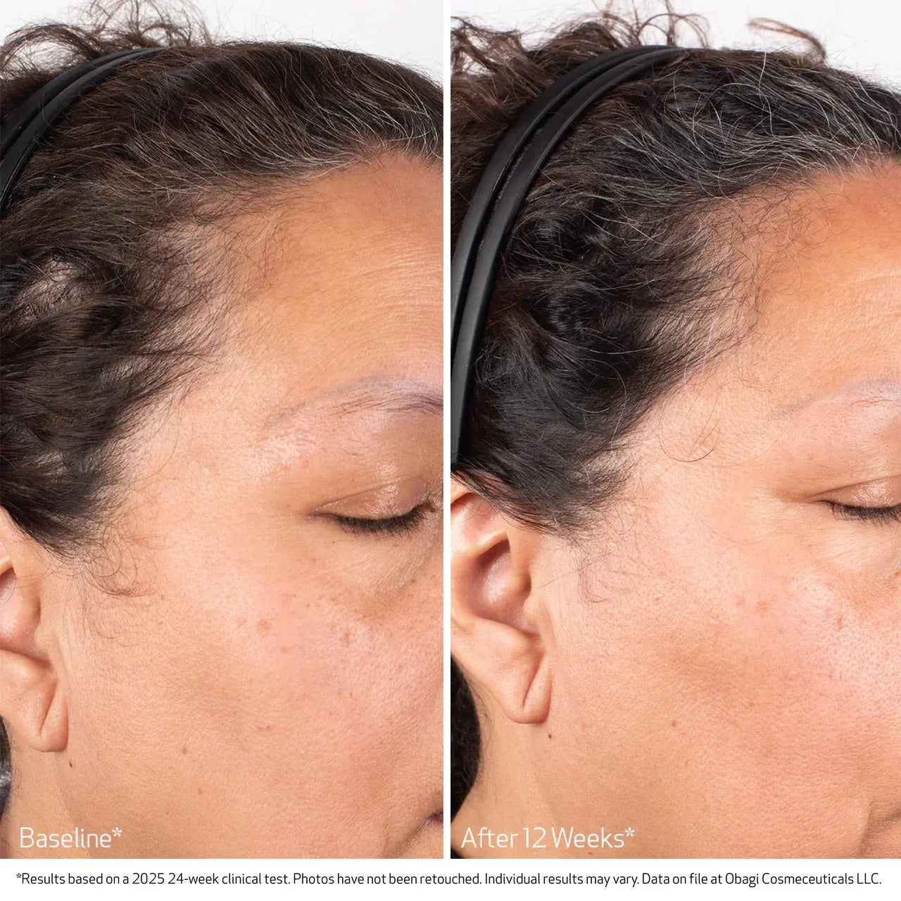Nu-Cil BioStim Scalp Serum before and after — result 1