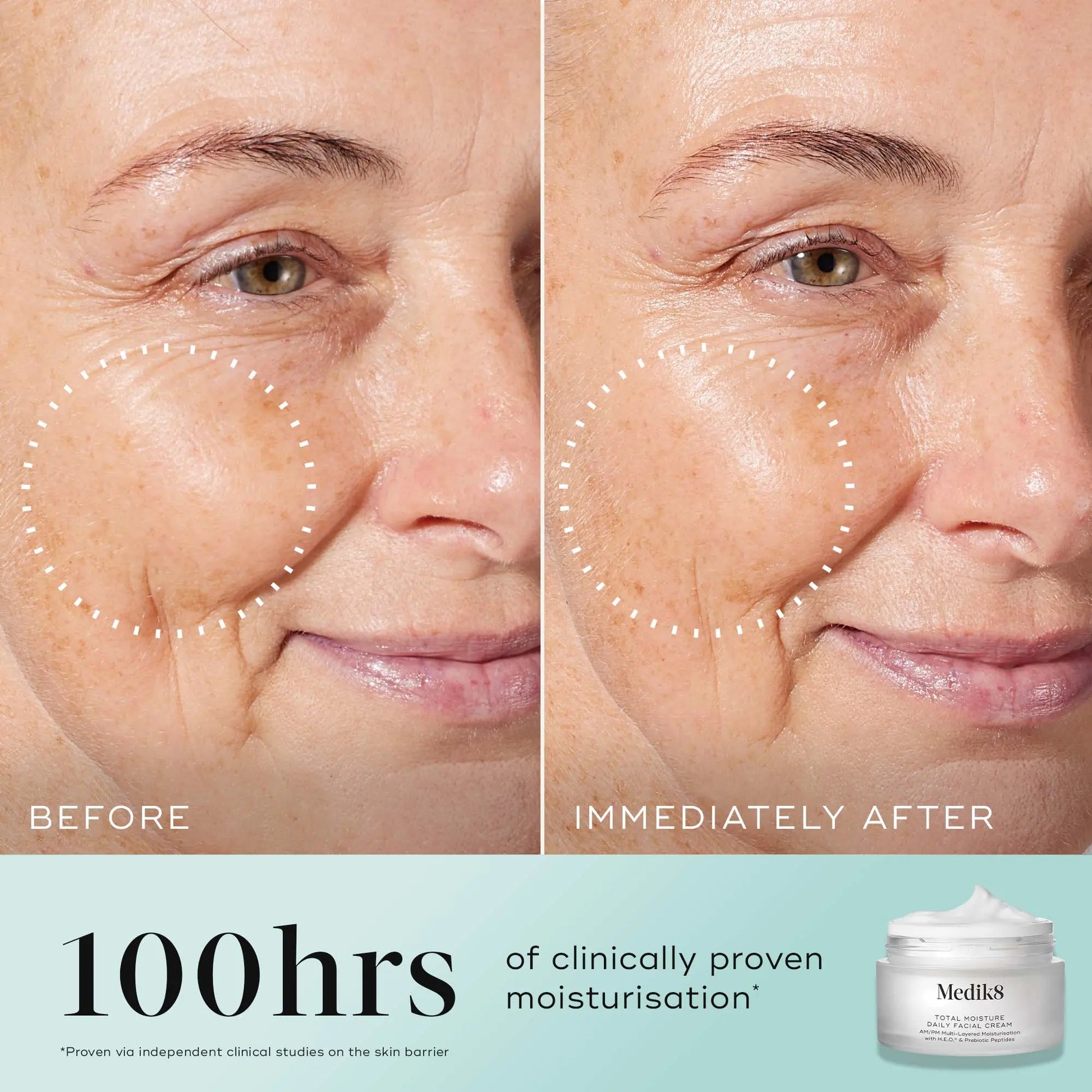 Medik8 Medik8 Total Moisture Daily Facial Cream 50ml - Image 3